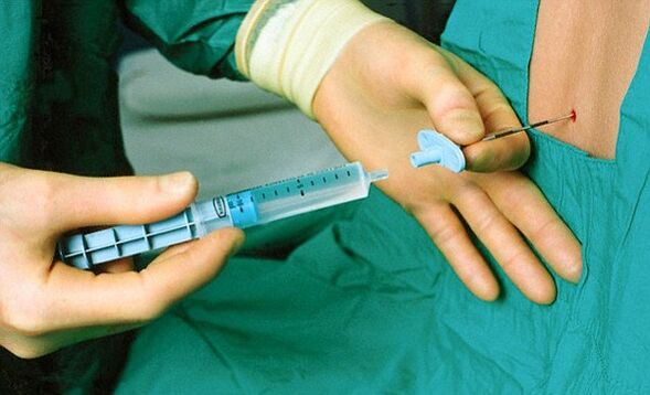 treatment of osteochondrosis with injections