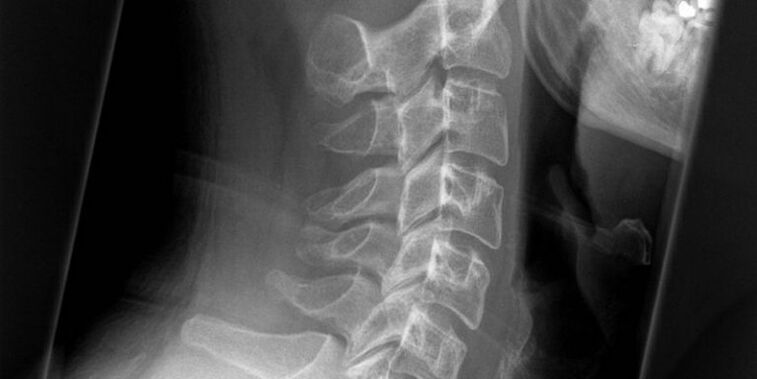 An image of the cervical region
