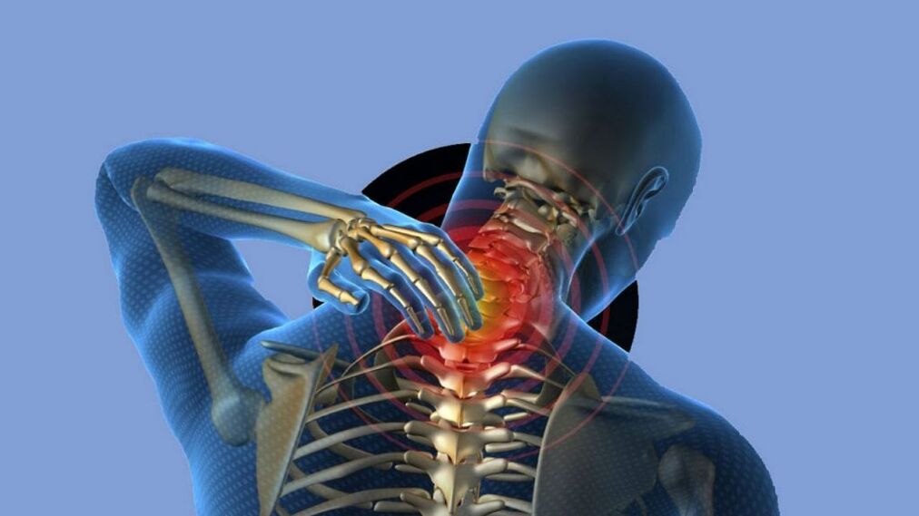 Osteochondrosis of the cervical region