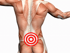 Symptoms and treatment of lumbar osteochondosis